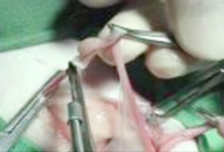 去勢手術・避妊手術における血管のシーリング